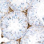 Cathepsin D Antibody in Immunohistochemistry (Paraffin) (IHC (P))