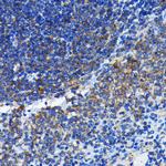 BAX Antibody in Immunohistochemistry (Paraffin) (IHC (P))