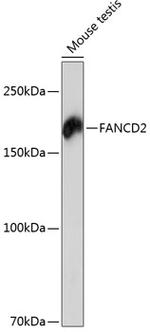 FANCD2 Antibody in Western Blot (WB)