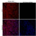 BCL-2 Antibody in Immunohistochemistry (Paraffin) (IHC (P))