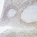 BCL-2 Antibody in Immunohistochemistry (Paraffin) (IHC (P))