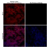 BCL-2 Antibody in Immunohistochemistry (Paraffin) (IHC (P))