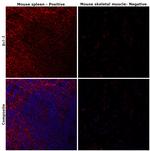 BCL-2 Antibody in Immunohistochemistry (Paraffin) (IHC (P))