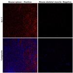 BCL-2 Antibody in Immunohistochemistry (Paraffin) (IHC (P))