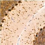 PIM1 Antibody in Immunohistochemistry (Paraffin) (IHC (P))