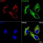 VDAC Antibody in Immunocytochemistry (ICC/IF)