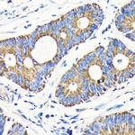 VDAC Antibody in Immunohistochemistry (Paraffin) (IHC (P))