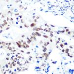 HDAC9 Antibody in Immunohistochemistry (Paraffin) (IHC (P))