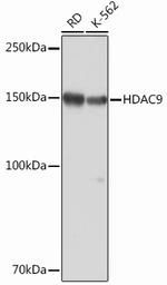 HDAC9 Antibody in Western Blot (WB)