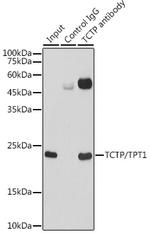 TPT1 Antibody in Immunoprecipitation (IP)