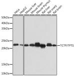 TPT1 Antibody in Western Blot (WB)