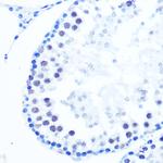 POLB Antibody in Immunohistochemistry (Paraffin) (IHC (P))