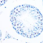 POLB Antibody in Immunohistochemistry (Paraffin) (IHC (P))