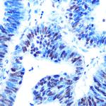 USP7 Antibody in Immunohistochemistry (Paraffin) (IHC (P))