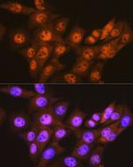 PSMA1 Antibody in Immunocytochemistry (ICC/IF)