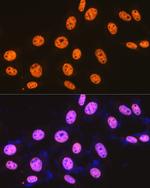 SFPQ Antibody in Immunocytochemistry (ICC/IF)