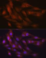 Ub-K48 Antibody in Immunocytochemistry (ICC/IF)