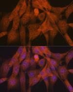 Ub-K48 Antibody in Immunocytochemistry (ICC/IF)