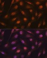 Ub-K48 Antibody in Immunocytochemistry (ICC/IF)