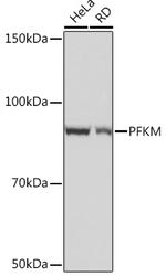 PFKM Antibody in Western Blot (WB)