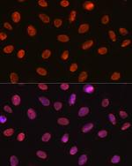 SNRPA Antibody in Immunocytochemistry (ICC/IF)