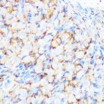 Filamin A Antibody in Immunohistochemistry (Paraffin) (IHC (P))