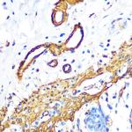 Filamin A Antibody in Immunohistochemistry (Paraffin) (IHC (P))