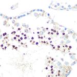 HP1 alpha Antibody in Immunohistochemistry (Paraffin) (IHC (P))