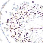 HP1 alpha Antibody in Immunohistochemistry (Paraffin) (IHC (P))