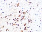 PUMA alpha Antibody in Immunohistochemistry (Paraffin) (IHC (P))