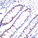 Angiopoietin 1 Antibody in Immunohistochemistry (Paraffin) (IHC (P))