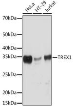 TREX1 Antibody in Western Blot (WB)