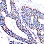 MTCO2 Antibody in Immunohistochemistry (Paraffin) (IHC (P))