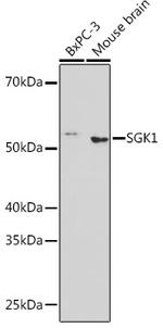 SGK1 Antibody in Western Blot (WB)