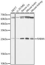 Rab4 Antibody in Western Blot (WB)