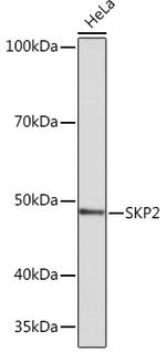 SKP2 Antibody in Western Blot (WB)