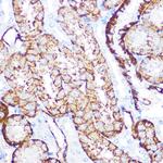 NDRG1 Antibody in Immunohistochemistry (Paraffin) (IHC (P))