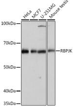 RBPJ Antibody in Western Blot (WB)