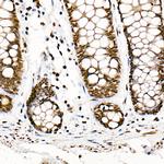 SRSF1 Antibody in Immunohistochemistry (Paraffin) (IHC (P))