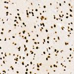 SRSF1 Antibody in Immunohistochemistry (Paraffin) (IHC (P))