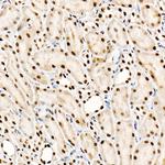 SRSF1 Antibody in Immunohistochemistry (Paraffin) (IHC (P))