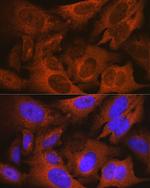 MSMB Antibody in Immunocytochemistry (ICC/IF)