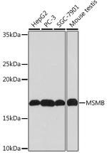 MSMB Antibody in Western Blot (WB)