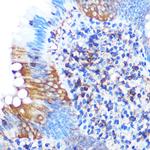 PGAM1 Antibody in Immunohistochemistry (Paraffin) (IHC (P))