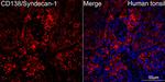 CD138 Antibody in Immunohistochemistry (Paraffin) (IHC (P))