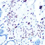 Emerin Antibody in Immunohistochemistry (Paraffin) (IHC (P))