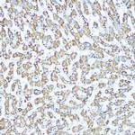 CPS1 Antibody in Immunohistochemistry (Paraffin) (IHC (P))