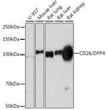 CD26 Antibody in Western Blot (WB)