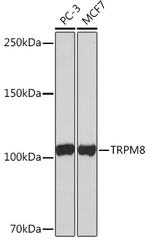 TRPM8 Antibody in Western Blot (WB)