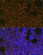 CCR8 Antibody in Immunocytochemistry (ICC/IF)